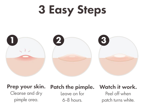 Three-step guide for using a pimple patch with icons and text.