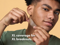 Person applying a skincare product with text 'XL coverage for XL breakouts' on a beige background