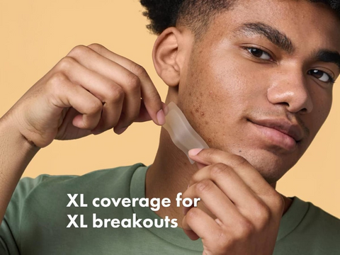 Person applying a skincare product with text 'XL coverage for XL breakouts' on a beige background